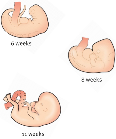 6 weeks               8 weeks                11 weeks